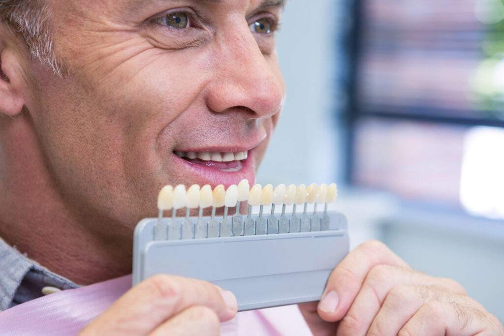 Implantes dentales con financiación en Retiro-Pacífico